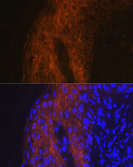 IL1RN Antibody