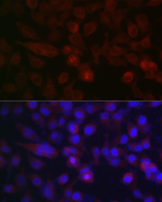 AURKA Antibody