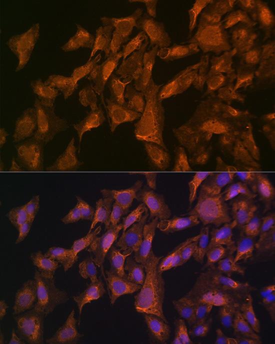VEGFB Antibody