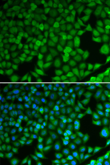 NDRG1 Antibody