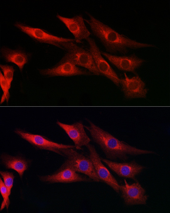 CYP1A1 Antibody