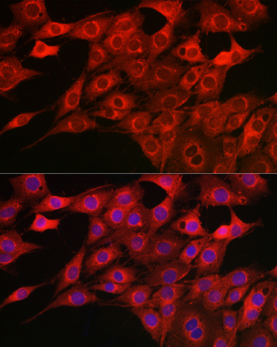 CYP1A1 Antibody