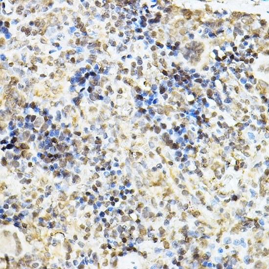 NR3C1 Antibody