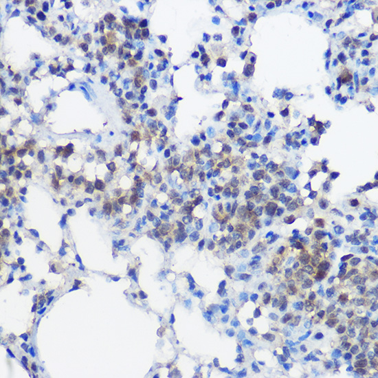 UBE2I Antibody