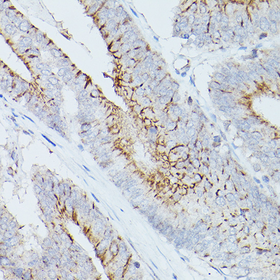 CLDN1 Antibody