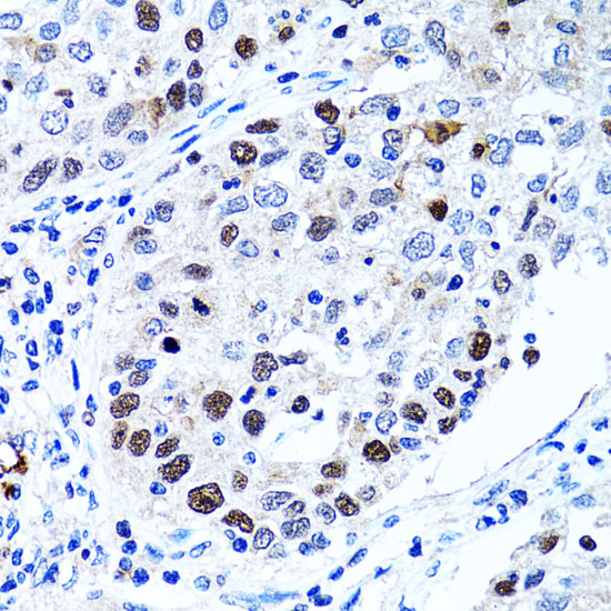 UHRF1 Antibody