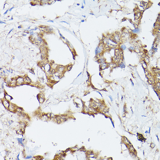 HSPA8 Antibody