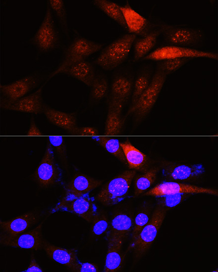 PLK1 Antibody