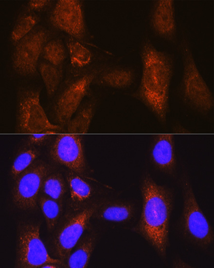 PLK1 Antibody