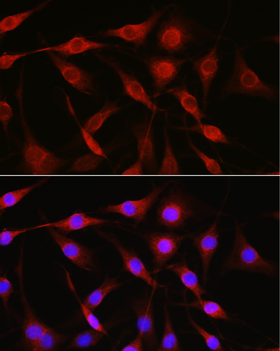 LAMP1 Antibody