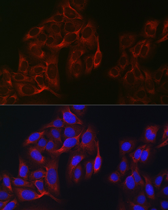 EIF4A1 Rabbit mAb