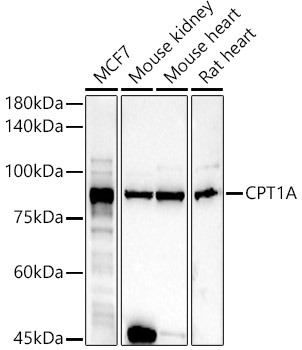 CPT1A Antibody