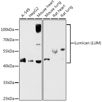 LTBR Antibody