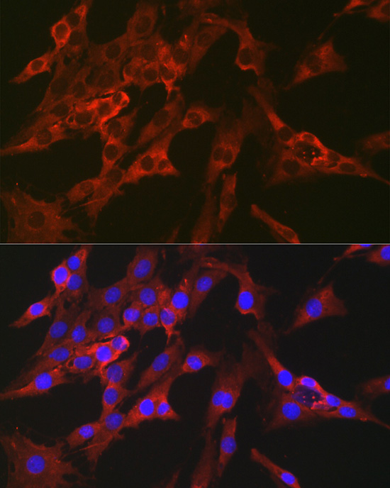FBP1 Antibody