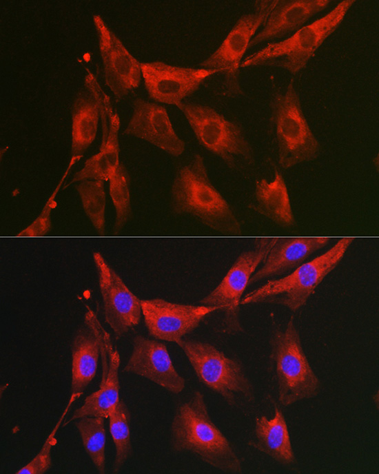 FBP1 Antibody