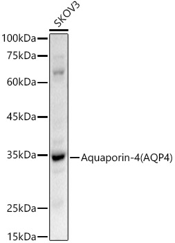 AQP4 Antibody