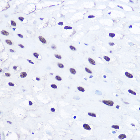 TP53BP1 Antibody