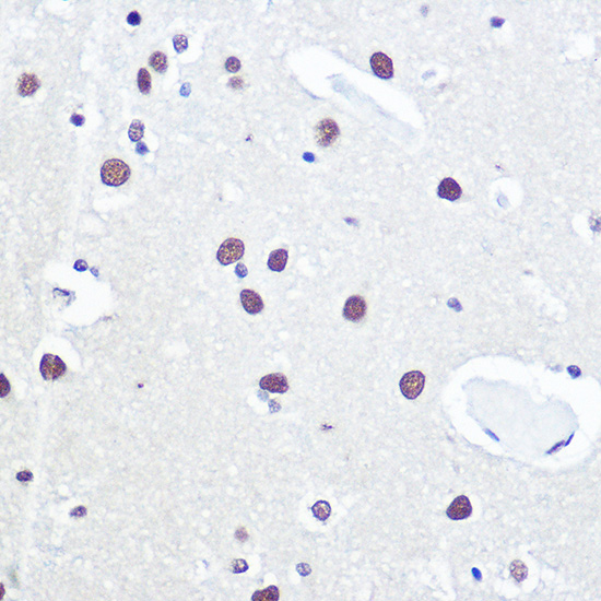 TP53BP1 Antibody