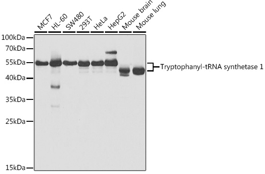 WARS Antibody