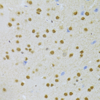 ANP32A Antibody