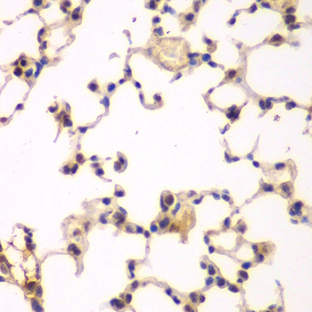 NFKBIB Antibody