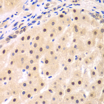 NFKBIB Antibody