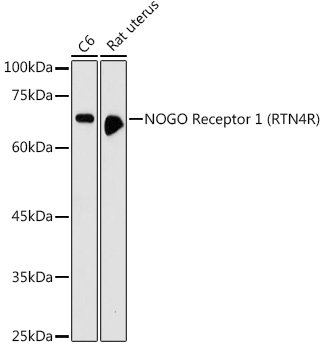 RTN4R Antibody