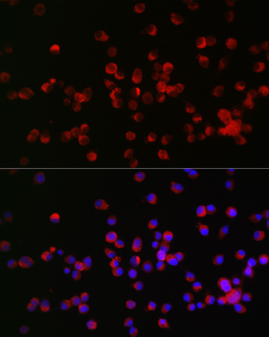 RTN4R Antibody