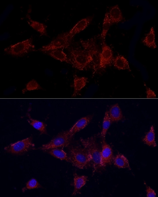 MMP2 Antibody