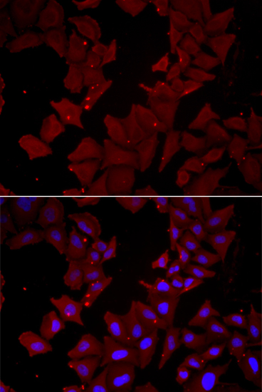 ET-2 Antibody