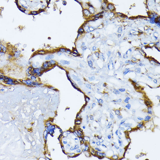 HSPA5 antibody