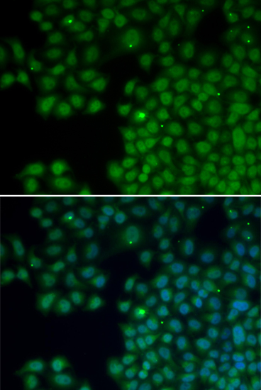 NUDT6 antibody