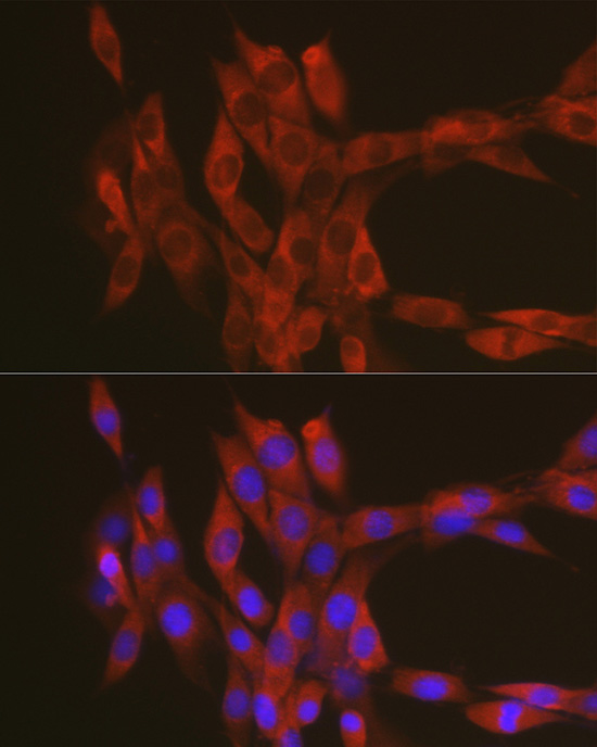RhoA antibody