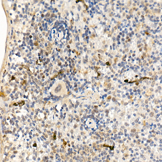 ABL1 antibody