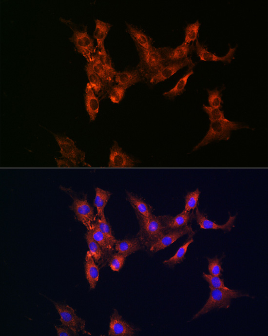 FASN antibody