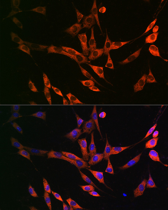 FASN antibody