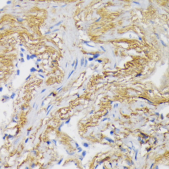 WNT3A antibody