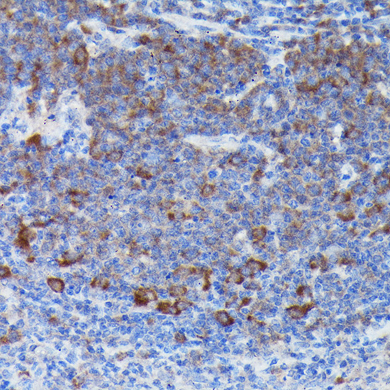 SOCS3 antibody