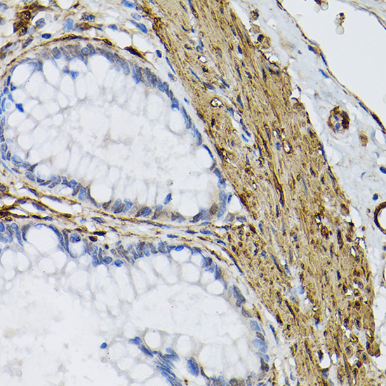 TGM2 antibody