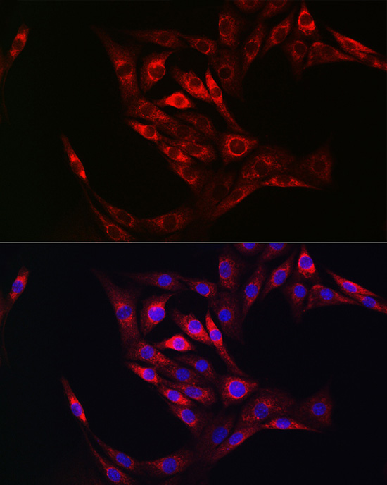 TGM2 antibody