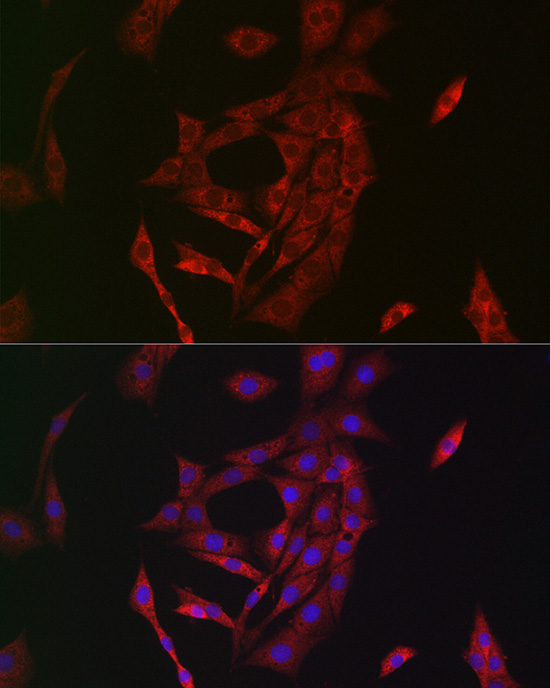 TGM2 antibody