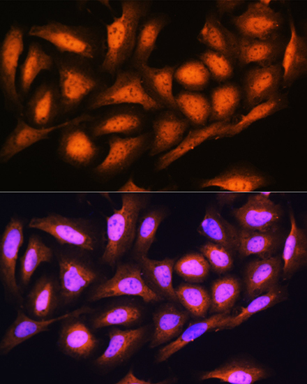 PSMD4 antibody