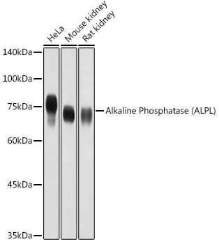 ALPL antibody