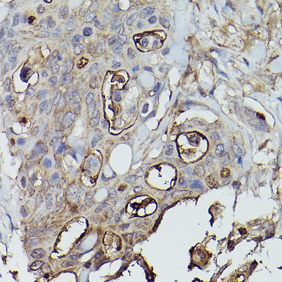 ALPL antibody