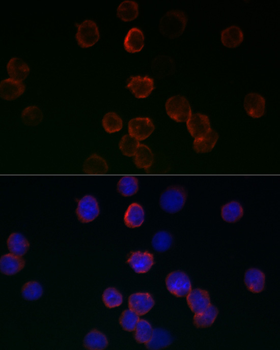GPX1 antibody