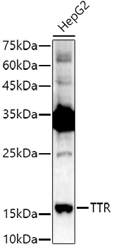 TTR antibody
