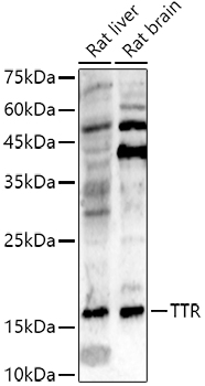 TTR antibody