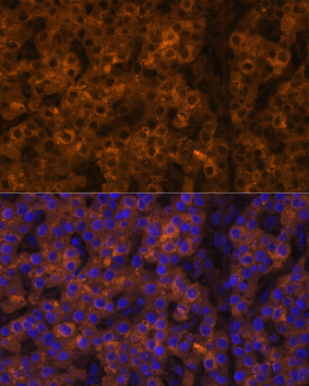 TTR antibody