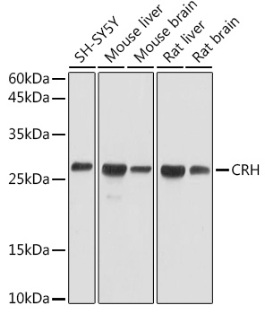 CRH antibody