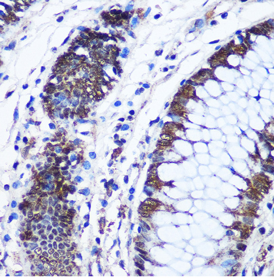 CTCF antibody
